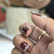 Splints